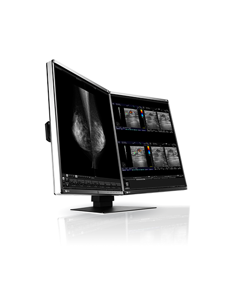 radiforce-medic-color-mammotomo-ref-3.jpg