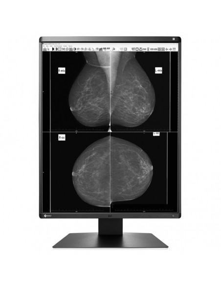 radiforce-medic-grayscale-mammo-ref-1.jpg