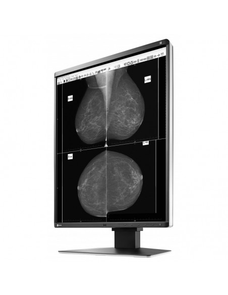 radiforce-medic-grayscale-mammo-ref-3.jpg