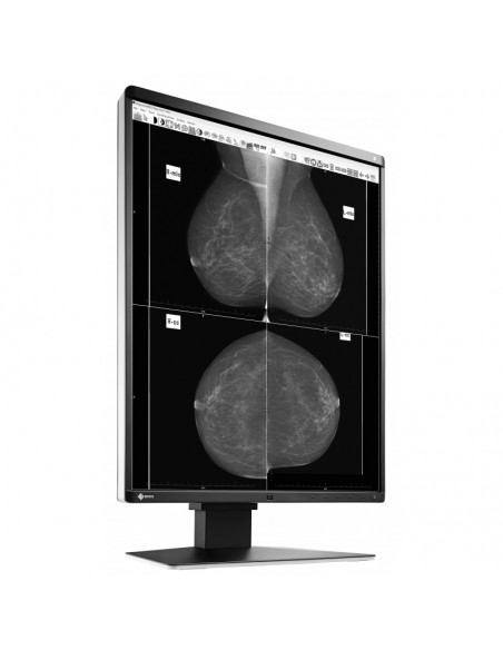 radiforce-medic-grayscale-mammo-ref-4.jpg